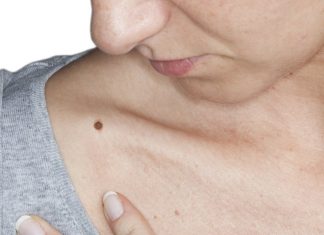 Scapa de alunite iarna!