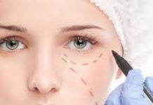 Blefaroplastia inferioara, recomandari si indicatii